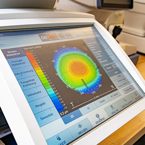 DSC09518 Monitor mit Sehanalyseergebnissen